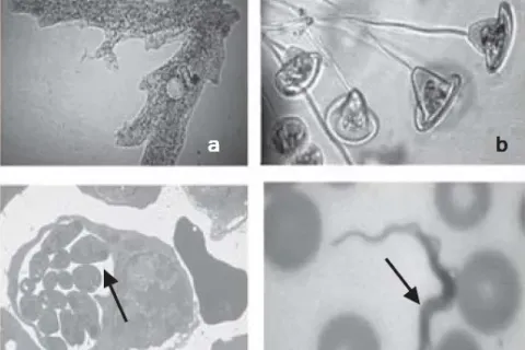 Contoh Protozoa Jkj545454
