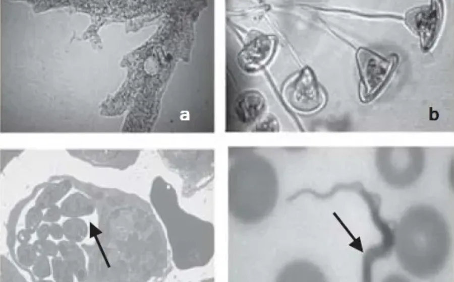 Contoh Protozoa Jkj545454
