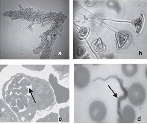 contoh protozoa jkj545454