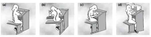 Tulang belakang (a) normal (b) skolisosis (c) kifosis dan d(d) lordosis