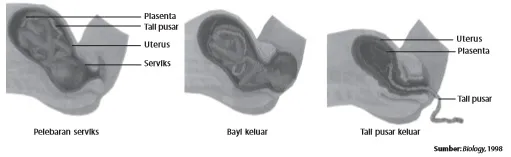 Proses kelahiran bayi