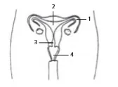 gambar bab 9 soal ganda no 9