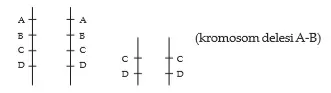 Delesi (defisiensi)