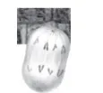 Anafase