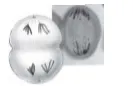 Anafase I