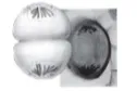 Telofase I