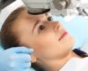 Mengenal Prosedur Operasi LASIK untuk Koreksi Penglihatan
