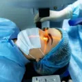 Manfaat Dan Risiko LASIK Yang Perlu Anda Ketahui